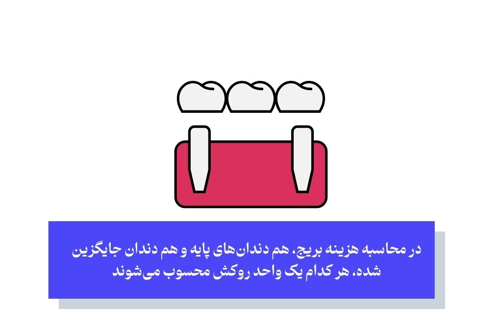 هر واحد بریج (پل دندانی) چند دندان است