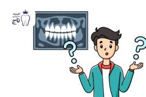 هر واحد دندان یعنی چی