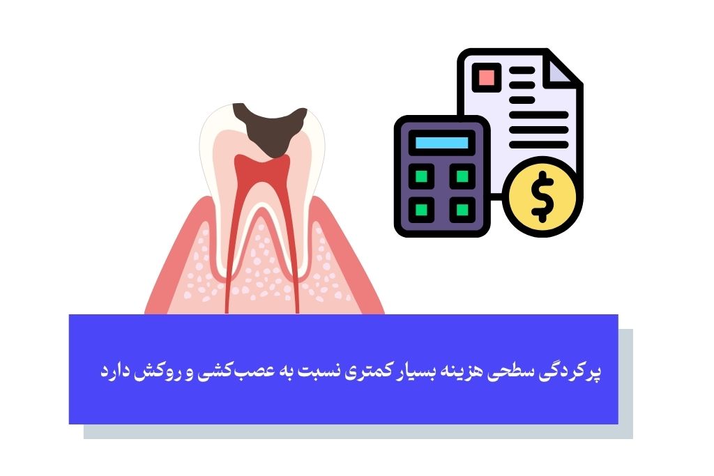 هزینه درمان پوسیدگی دندان در سال ۱۴۰۴؛ سرمایه‌گذاری برای سلامت دندان‌ها