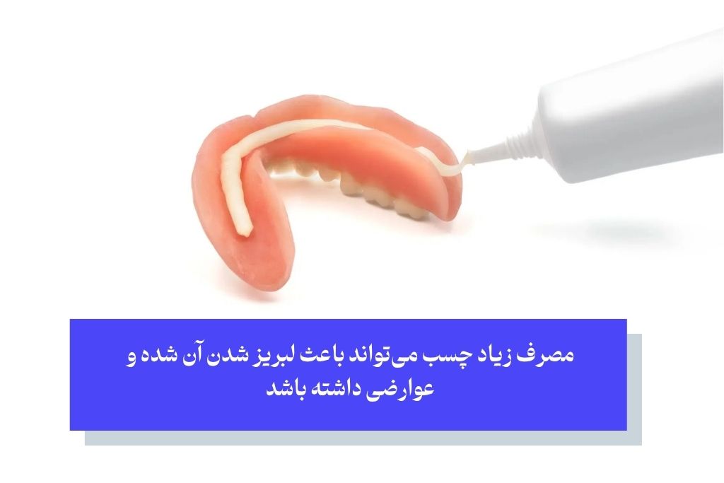 چسب لقی دندان مصنوعی