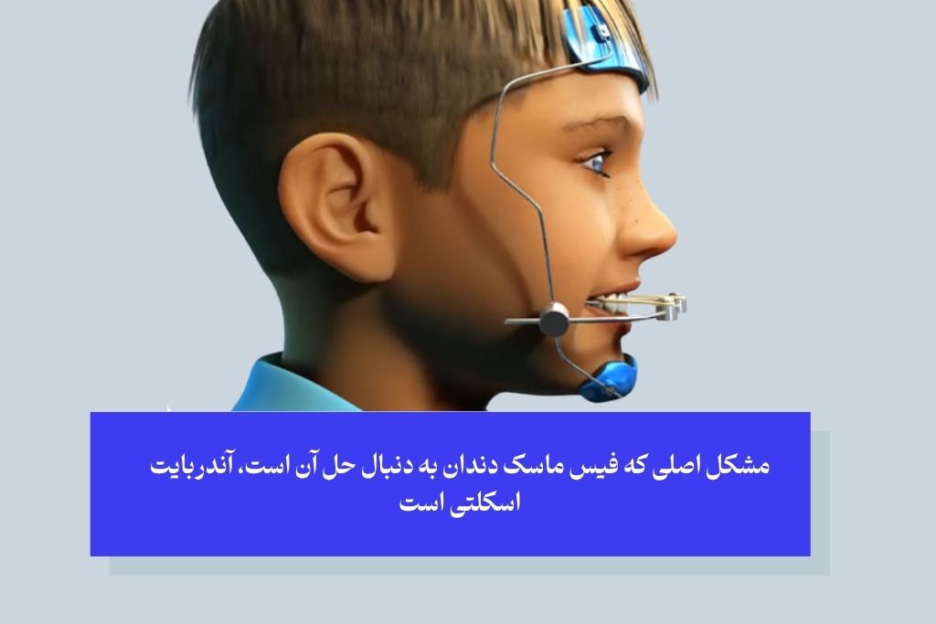 چه کودکانی به فیس ماسک ارتودنسی نیاز دارند
