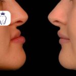 ارتودنسی و لاغری صورت