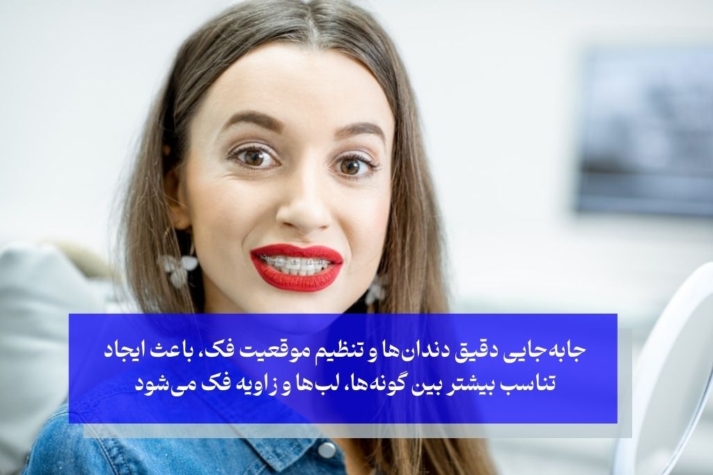 تاثیر ارتودنسی بر لاغری صورت و فرم چهره