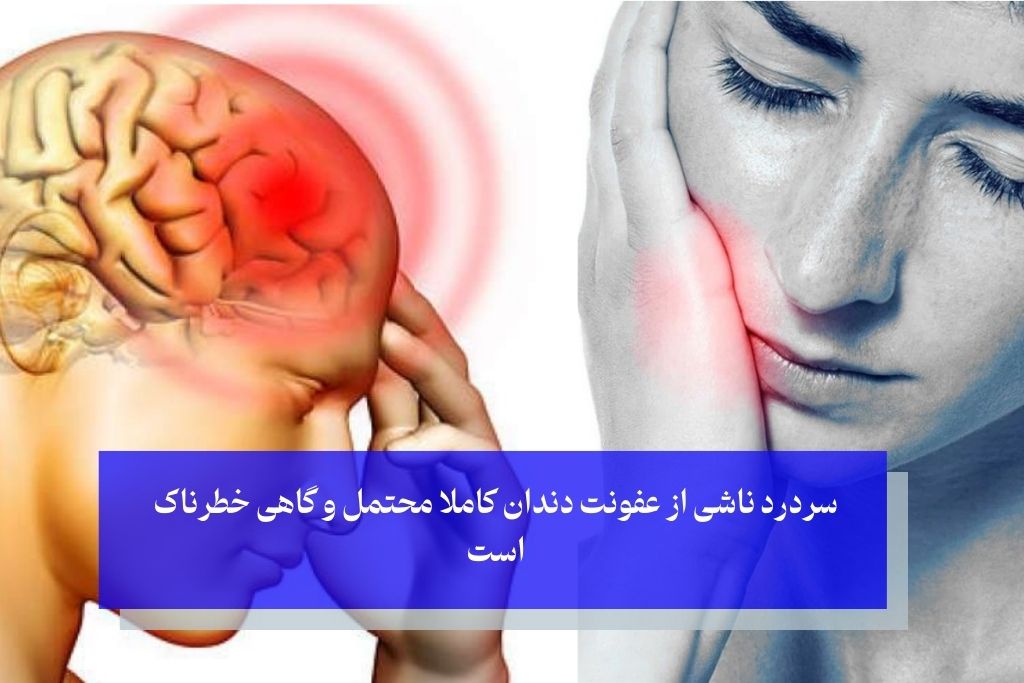 سردرد ناشی از عفونت دندان
