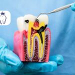 عصب کشی ناقص دندان