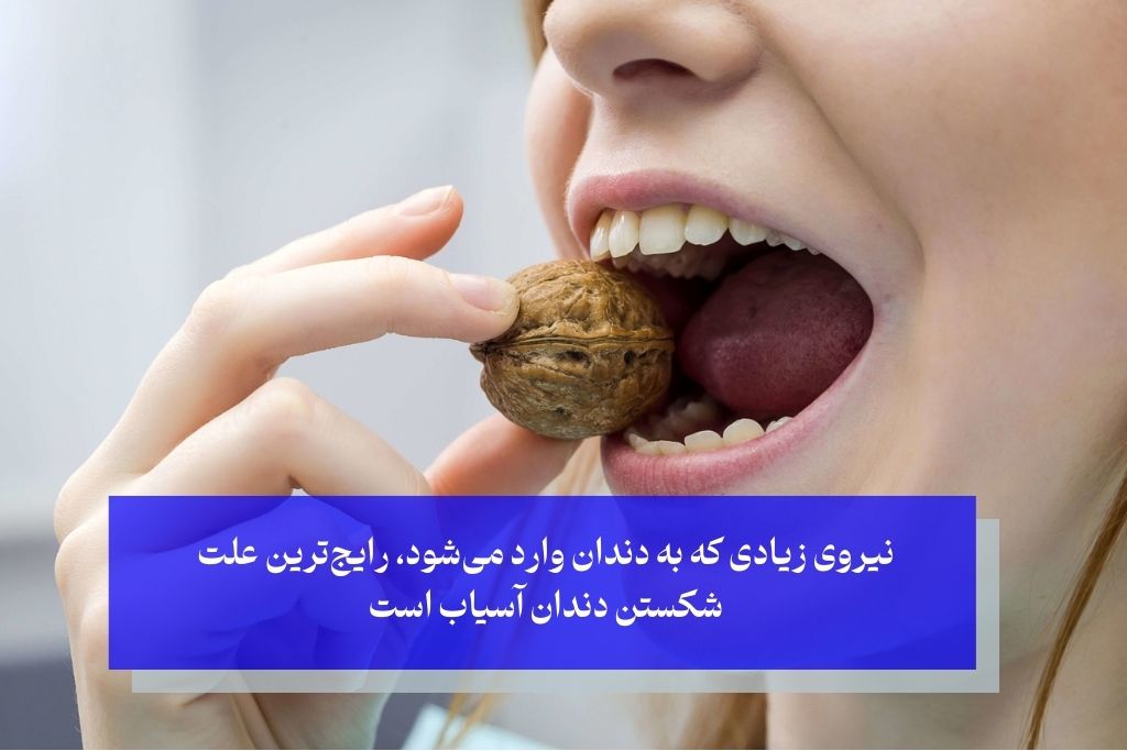 علت شکستن دندان آسیاب