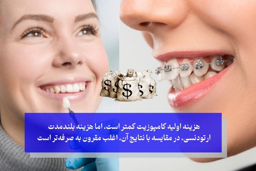 قیمت کامپوزیت بهتر است یا ارتودنسی؟