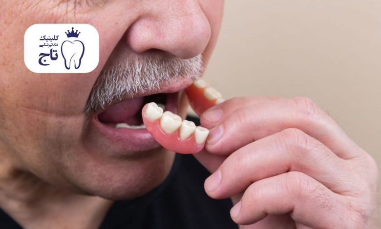 برای جا افتادن دندان مصنوعی چه کنیم