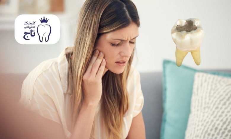 درد دندان بعد از پرکردن