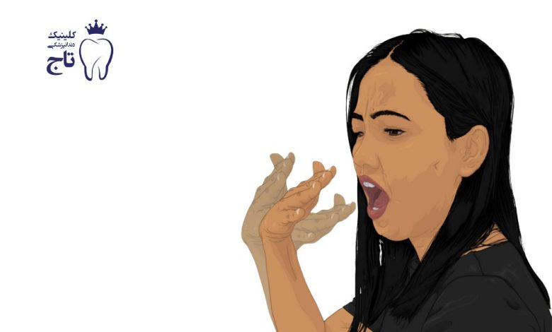 سندروم سوزش دهان