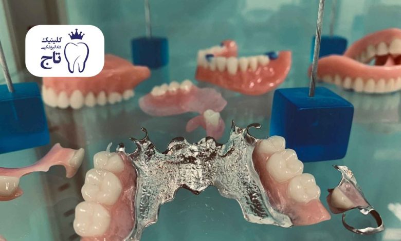 بهترین مارک دندان مصنوعی