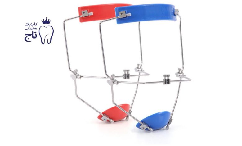 فیس ماسک ارتودنسی