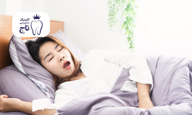 باز ماندن دهان در خواب