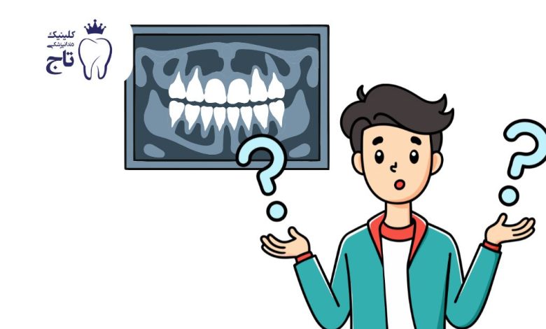 هر واحد دندان یعنی چی هر واحد دندان یعنی چی