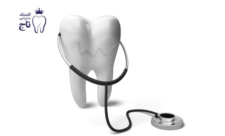 درمان پوسیدگی دندان