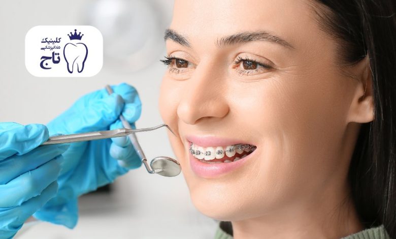 ارتودنسی بزرگسالان ارتودنسی بزرگسالان